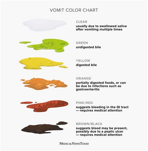 Vomit color chart: Various colors and their meanings .